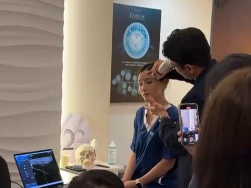 Radiesse Biostimulator